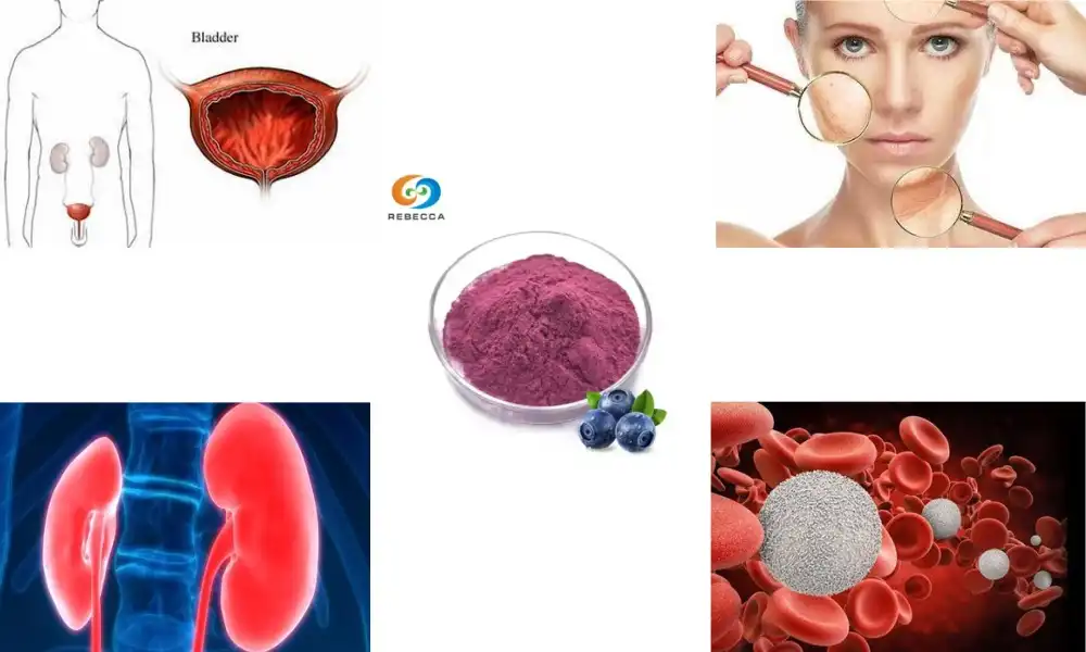 Is cranberry powder good for kidneys?
